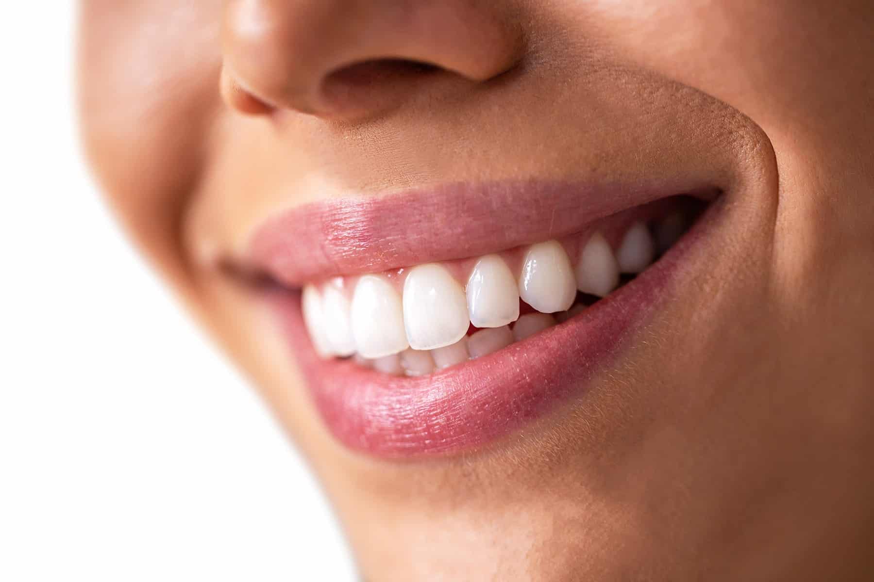 Dental bleaching services in Cumming, GA