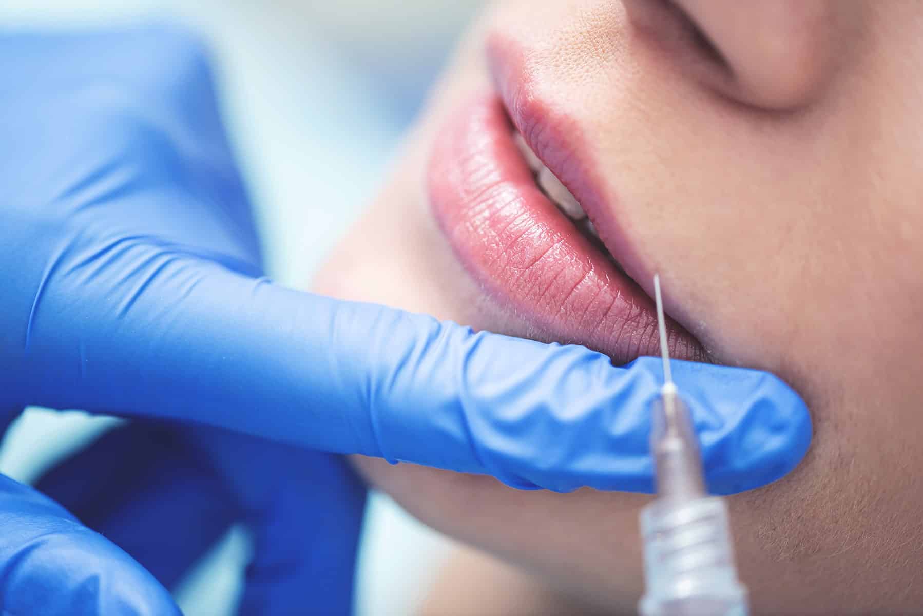 Dental botox appointment in Cumming, GA