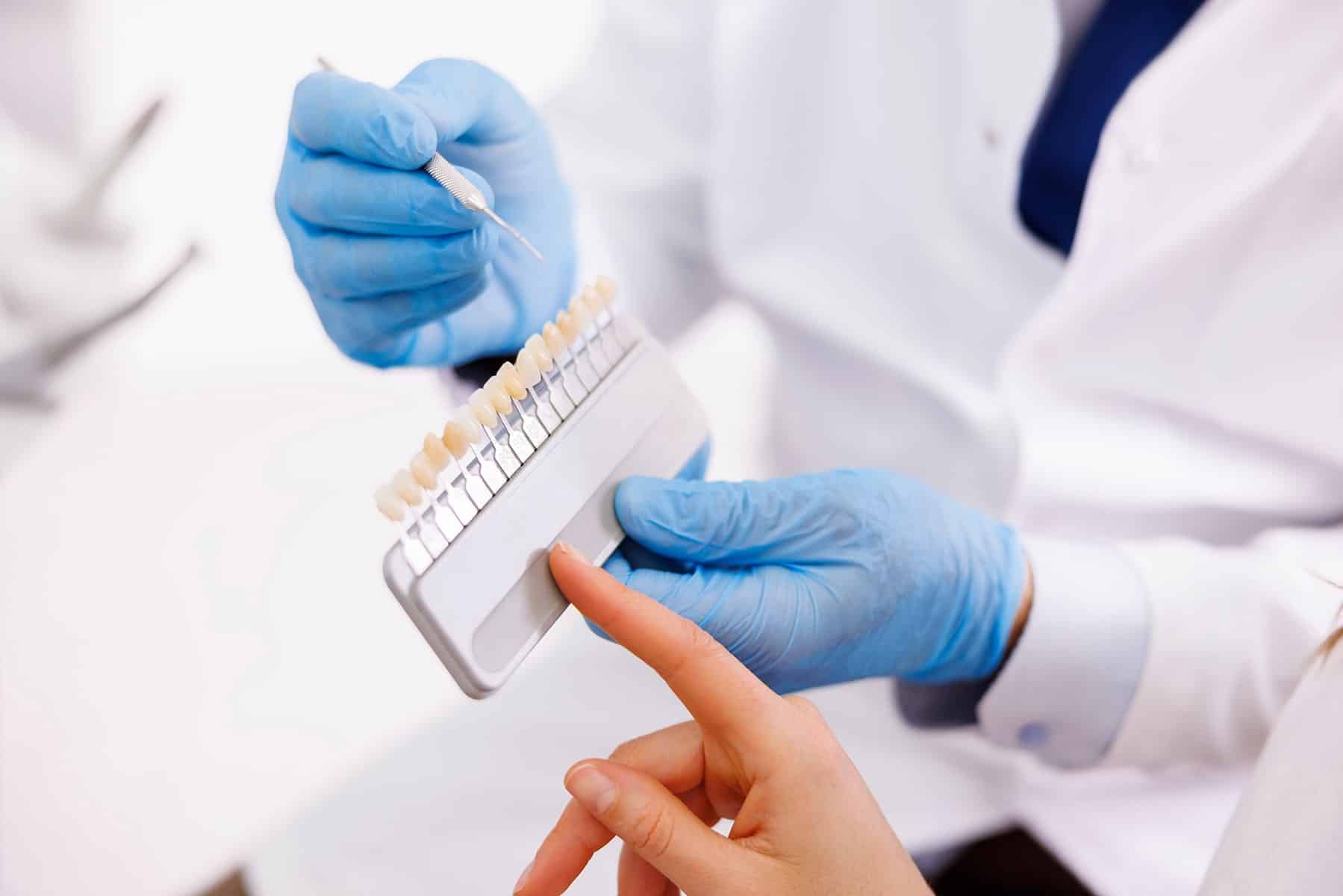Dental veneer treatment in Cumming, GA