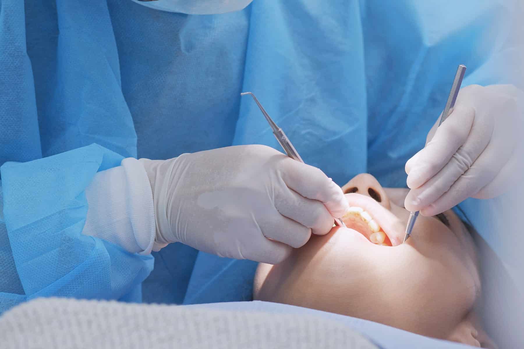 Dental deep cleaning in Cumming, GA